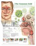   Understanding the Common Cold Anatomical Chart, 2nd Edition